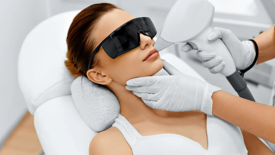 facial-laser-hair-removal