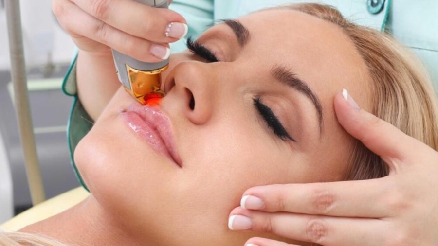 Face-Laser-Hair-Removal