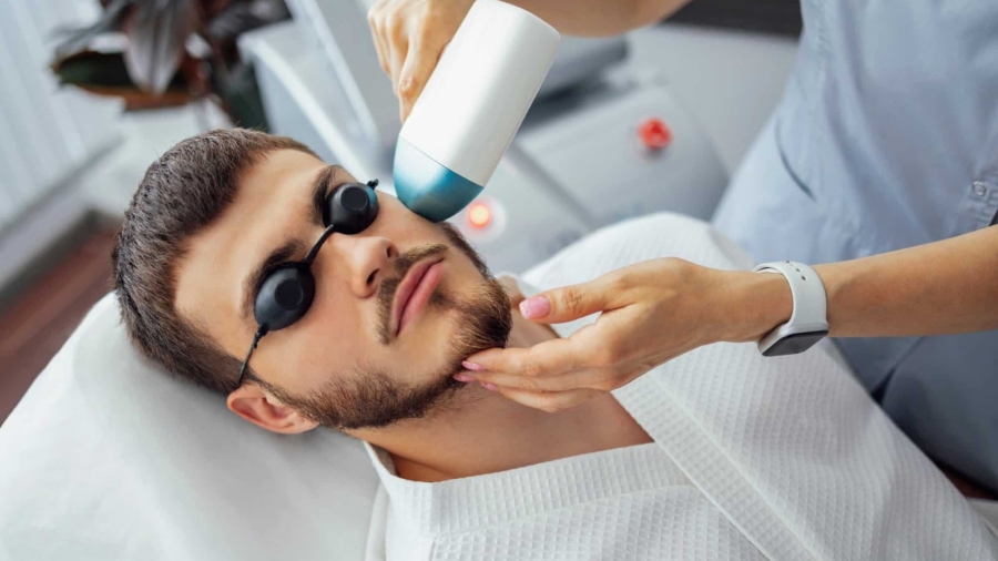 mens-facial-hair-removal