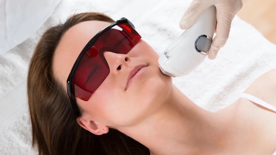 Lazer facial hair removal
