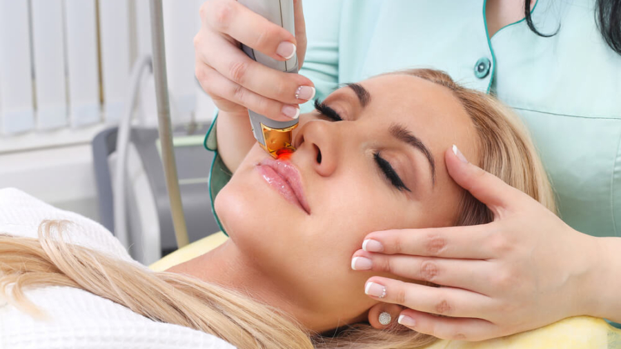 face-hair-removal (1)