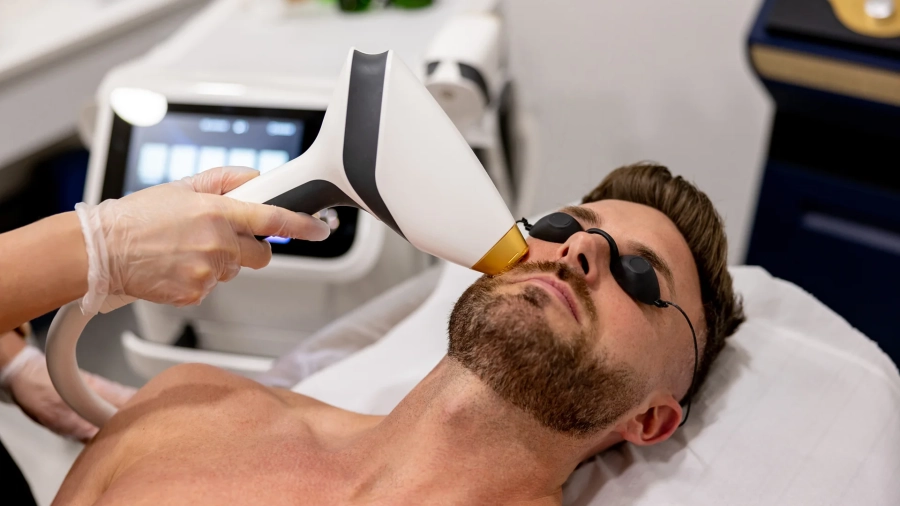 laser-hair-removal-face